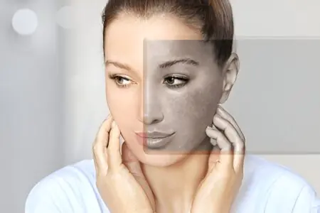 5 وصفات منزلية لتفتيح البشرة